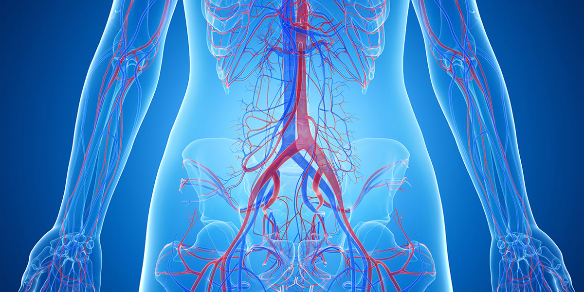 Paradontitis: Folgen in den Arterien